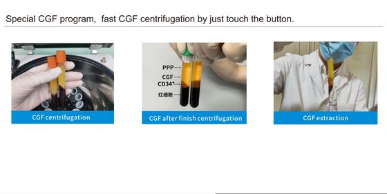 CENCE TD4 PRP Centrifuge Machine with 4000 RPM, ABS Plastic Construction, and 8x15ml Rotor Capacity for Laboratory Use